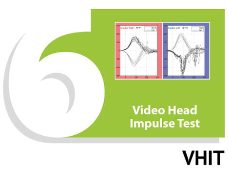 Video Head Impulse Test