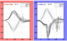 EEG Signal Analysis