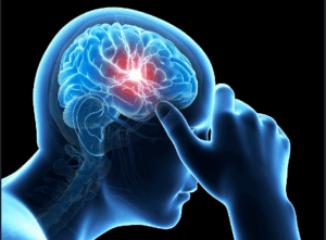 Neurological Assessment