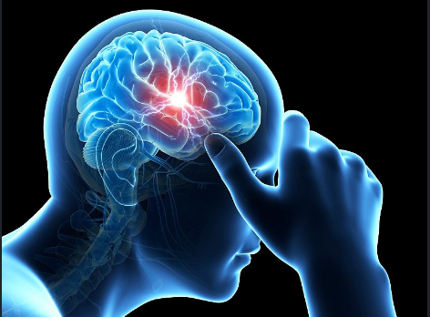 Neurological Assessment