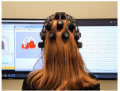 Quantitative EEG Brain Mapping